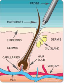 Electrolysis